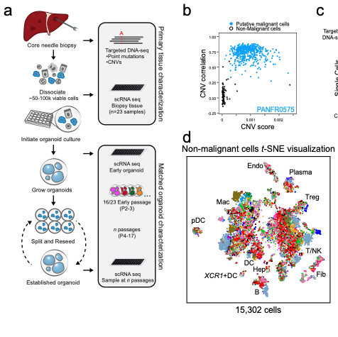 The tumor microenvironment drives transcriptional phenotypes and their plasticity in metastatic pancreatic cancer