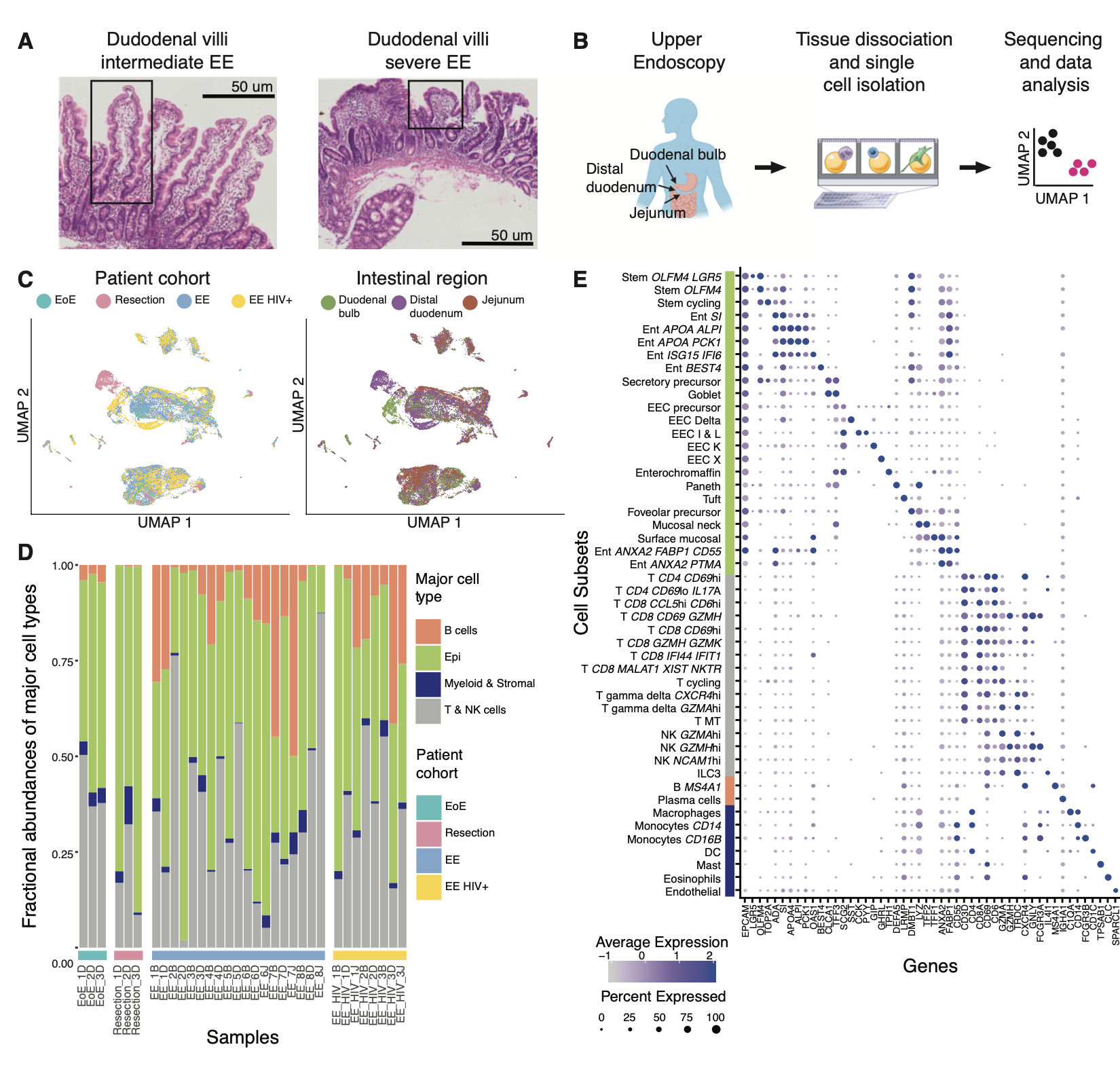 Single-cell profiling of environmental enteropathy reveals signatures of epithelial remodeling and immune activation in severe disease