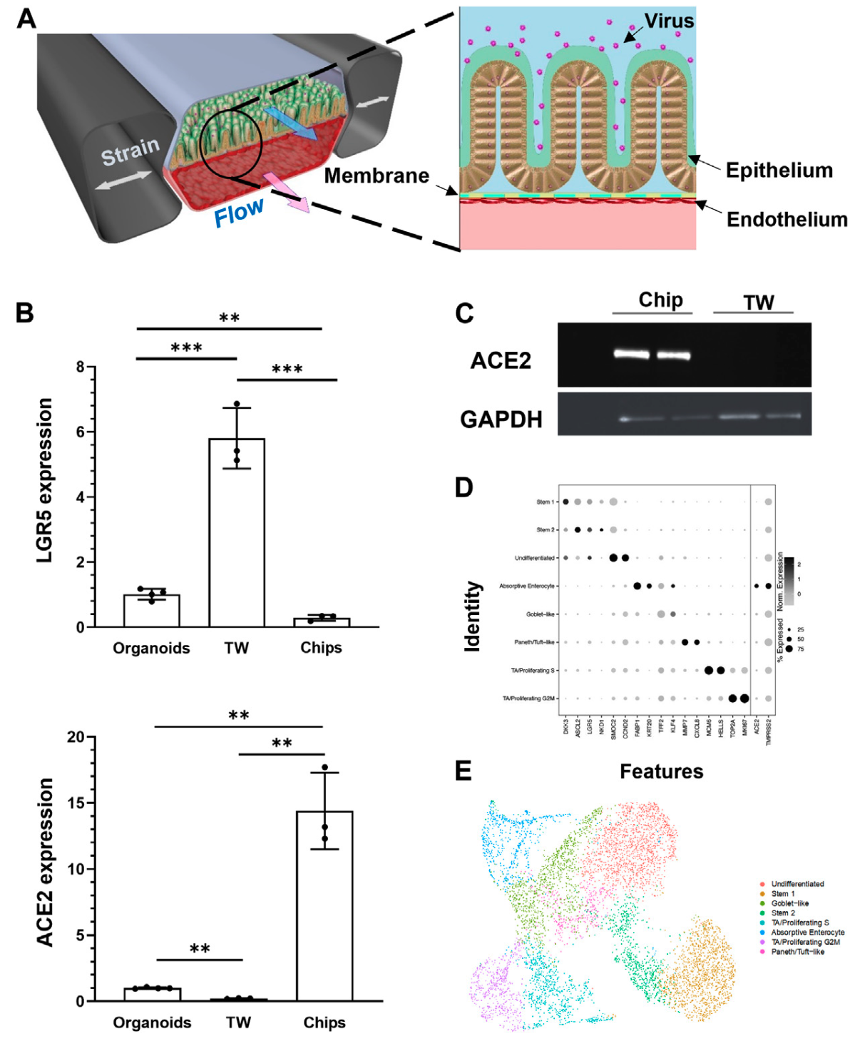 Enteric Coronavirus Infection and Treatment Modeled With an Immunocompetent Human Intestine-On-A-Chip