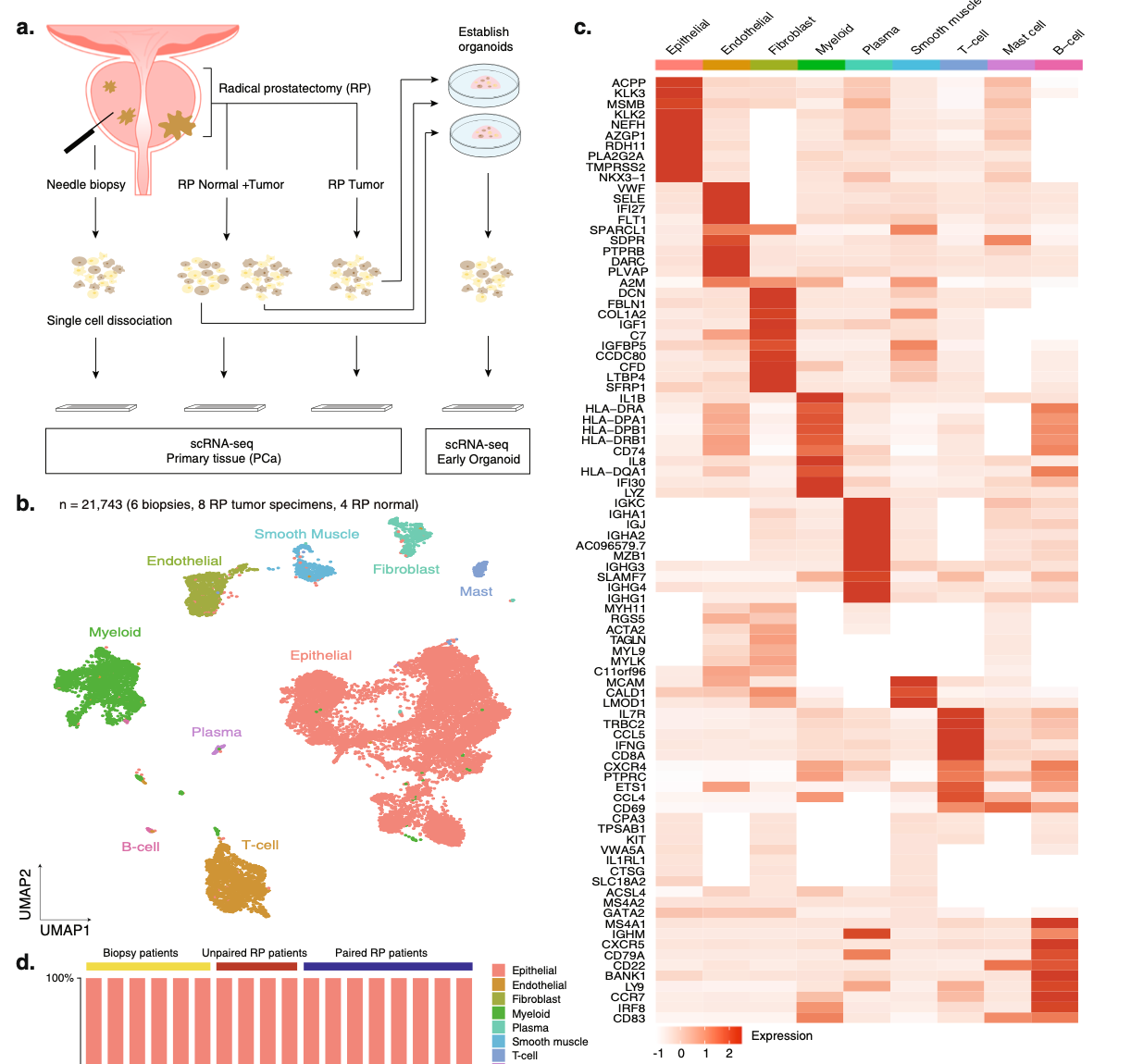 Single-cell analysis of human primary prostate cancer reveals the heterogeneity of tumor-associated epithelial cell states
