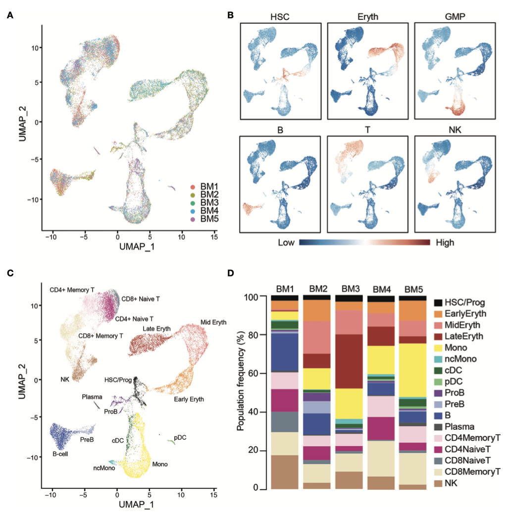 Single-Cell Multiomics Reveals Clonal T-Cell Expansions and Exhaustion in Blastic Plasmacytoid Dendritic Cell Neoplasm