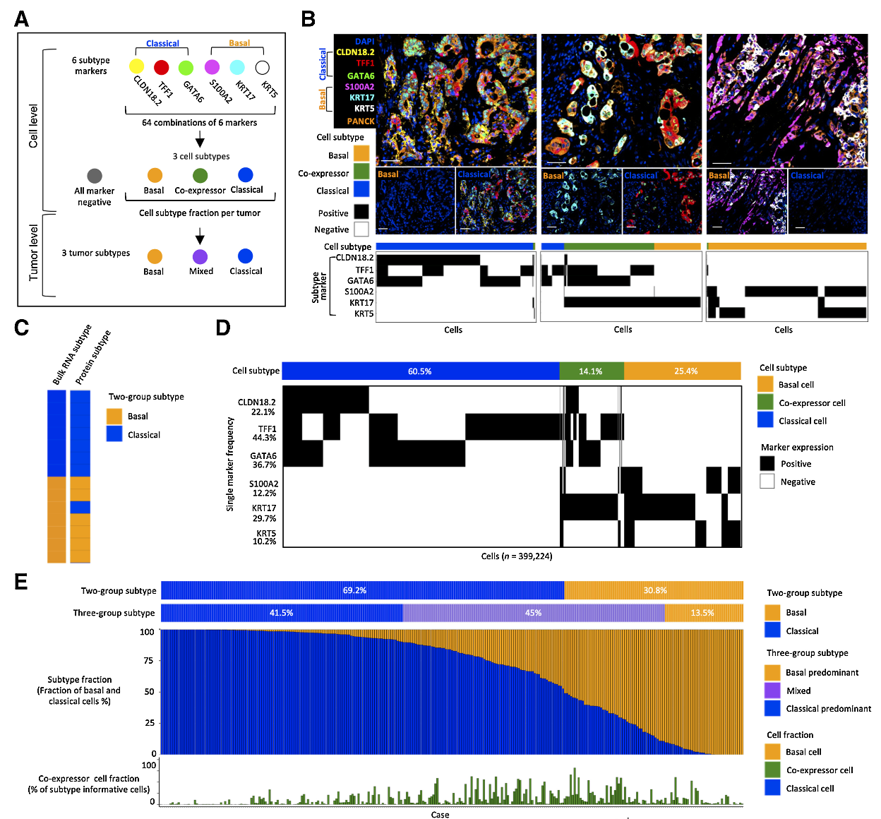 Spatially Resolved Single-Cell Assessment of Pancreatic Cancer Expression Subtypes Reveals Co-expressor Phenotypes and Extensive Intratumoral Heterogeneity